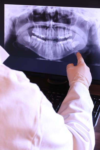 Best Emergency Dentist for Knocked-Out Tooth in Columbiana, OH