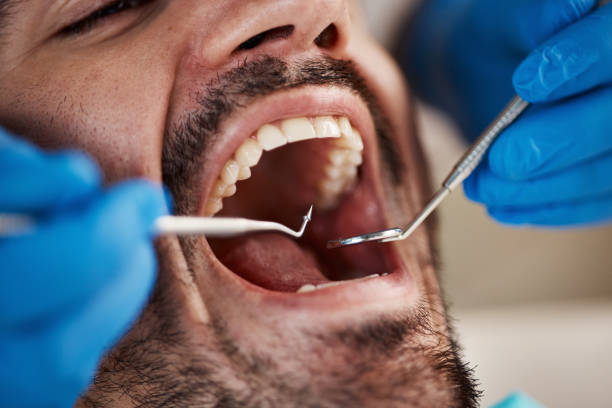 Best Emergency Root Canal Treatment in Columbiana, OH